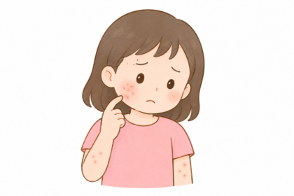 とびひと虫刺され・あせもの見分け方