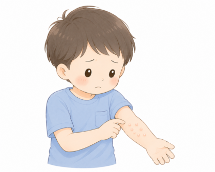 子どもの水いぼ、増える前に一度ご相談ください