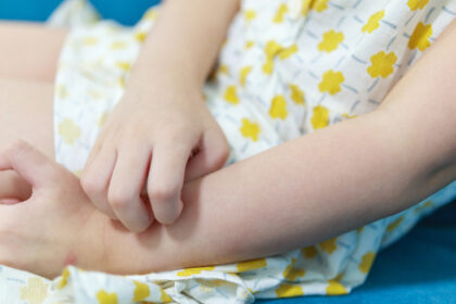 なぜ水いぼは次々に増えるの?